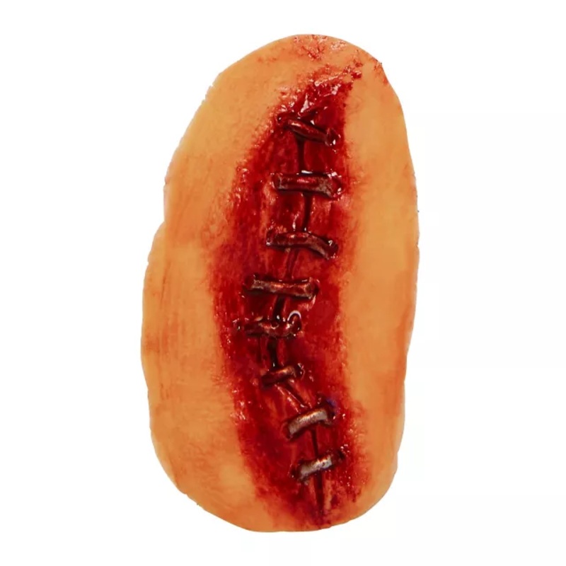 Metal Suture Appliance