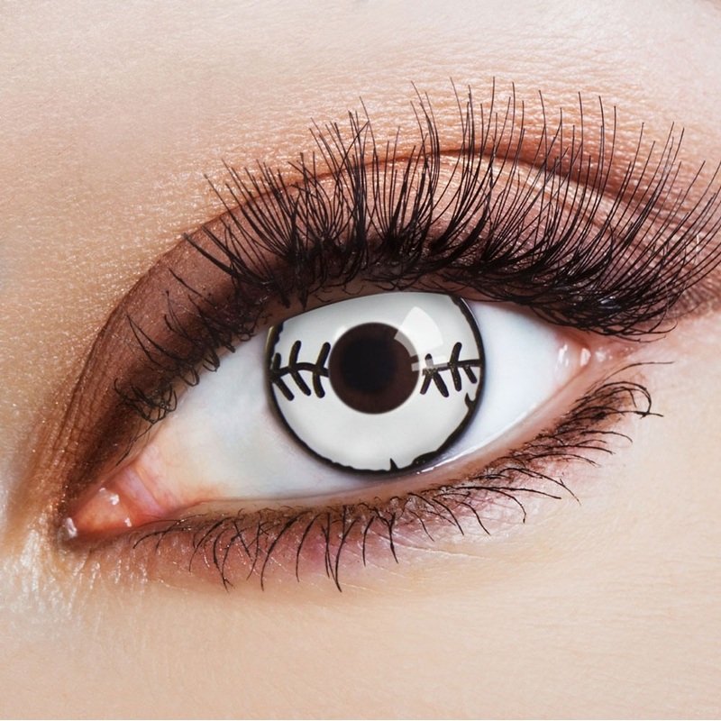 Annual contact lens. Mended scar