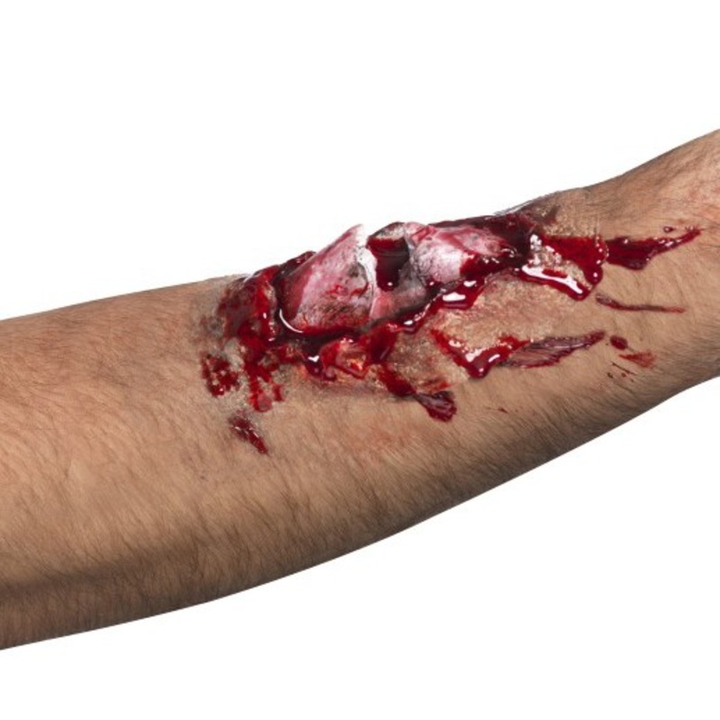 Open bone application