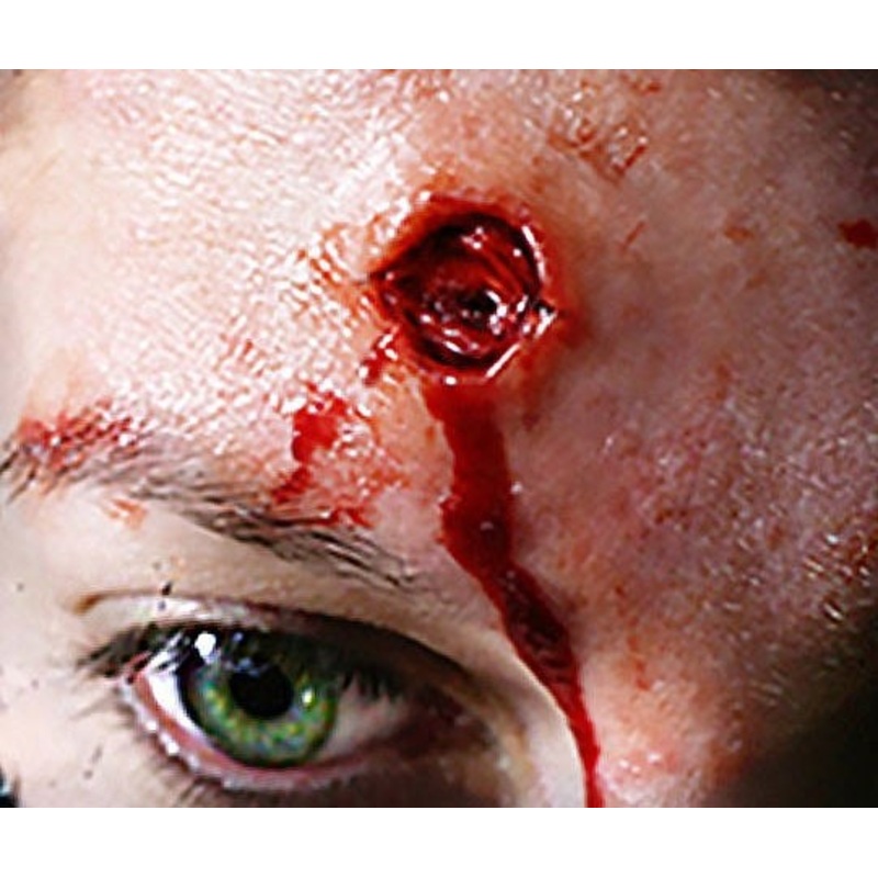 Self-adhesive 3D gunshot wound