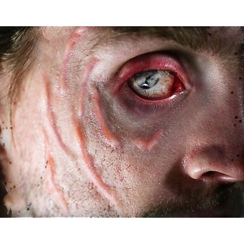 FX transfers scars